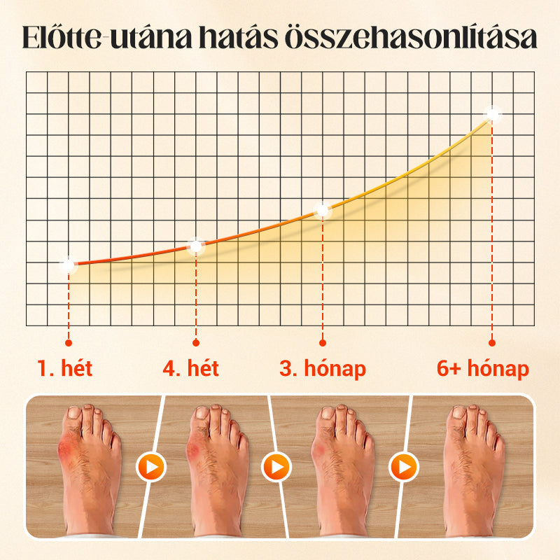 🔥Gorąca wyprzedaż🔥 Unisex niewidoczne, korygujące skarpetki pięciopalczaste